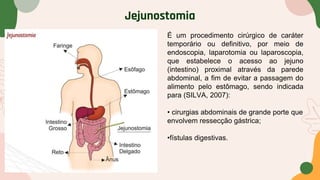 Jejunostomia
É um procedimento cirúrgico de caráter
temporário ou definitivo, por meio de
endoscopia, laparotomia ou laparoscopia,
que estabelece o acesso ao jejuno
(intestino) proximal através da parede
abdominal, a fim de evitar a passagem do
alimento pelo estômago, sendo indicada
para (SILVA, 2007):
• cirurgias abdominais de grande porte que
envolvem ressecção gástrica;
•fístulas digestivas.
 