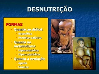 DESNUTRIÇÃO FORMAS Quanto ao déficit Específica Protéico-calórica Quanto ao metabolismo Hipocatabólica Hipercatabólica Quanto a evolução Aguda Crônica 