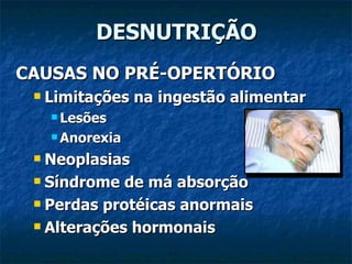 DESNUTRIÇÃO CAUSAS NO PRÉ-OPERTÓRIO Limitações na ingestão alimentar Lesões Anorexia Neoplasias Síndrome de má absorção Perdas protéicas anormais Alterações hormonais 