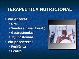 TERAPÊUTICA NUTRICIONAL Via enteral Oral Sondas ( nasal / oral ) Gastrostomias Jejunostomias Via parenteral Periférica Central 