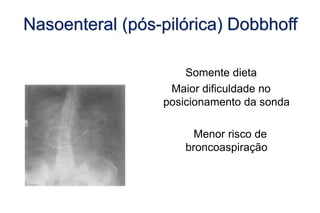 Nasoenteral (pós-pilórica) Dobbhoff
Somente dieta
Maior dificuldade no
posicionamento da sonda
Menor risco de
broncoaspiração
 