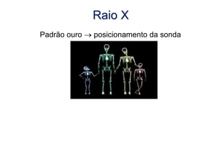 Raio X
Padrão ouro  posicionamento da sonda
 