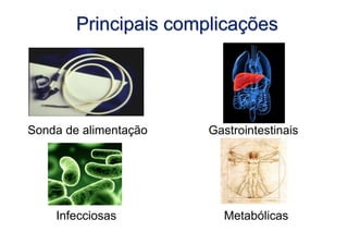 Principais complicações
Sonda de alimentação Gastrointestinais
Metabólicas
Infecciosas
 