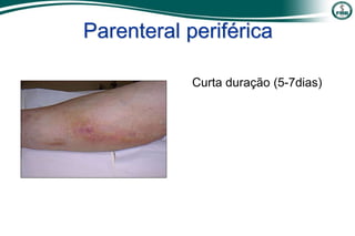 Parenteral periférica
Curta duração (5-7dias)
 