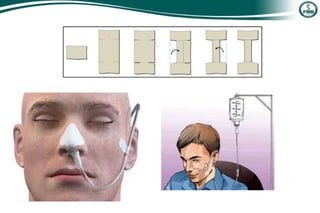 nutrição enteral e parenteral .ppt