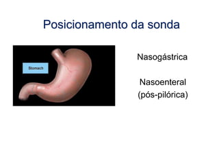 Posicionamento da sonda
Nasogástrica
Nasoenteral
(pós-pilórica)
 