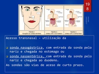 Acesso transnasal – utilização da
 sonda nasogástrica, com entrada da sonda pelo
nariz e chegada no estomago ou
 sonda nasoentérica, com entrada da sonda pelo
nariz e chegada ao duodeno.
As sondas são vias de aceso de curto prazo.
19
8
 
