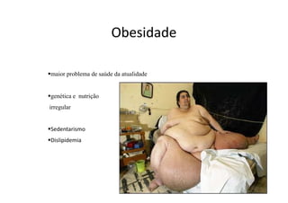 Obesidade
maior problema de saúde da atualidade
genética e nutrição
irregular
Sedentarismo
Dislipidemia
 