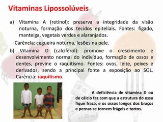 Vitaminas Lipossolúveis
a) Vitamina A (retinol): preserva a integridade da visão
noturna, formação dos tecidos epiteliais. Fontes: fígado,
manteiga, vegetais verdes e alaranjados.
Carência: cegueira noturna, lesões na pele.
b) Vitamina D (calciferol): promove o crescimento e
desenvolvimento normal do indivíduo, formação de ossos e
dentes, previne o raquitismo. Fontes: ovos, leite, peixes e
derivados, sendo a principal fonte a exposição ao SOL.
Carência: raquitismo.
A deficiência de vitamina D ou
de cálcio faz com que a estrutura do osso
fique fraca, e os ossos longos dos braços
e pernas se tornem frágeis e tortos.
 