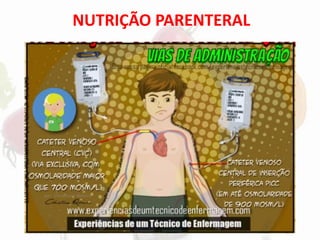 NUTRIÇÃO PARENTERAL
 