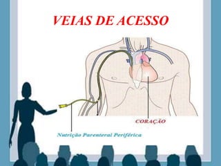 VEIAS DE ACESSO
 