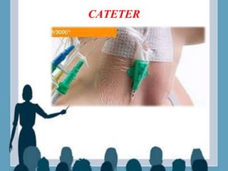 CATETER
 