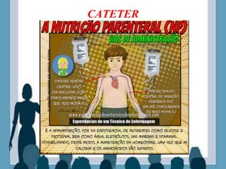 CATETER
 