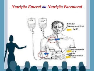 Nutrição Enteral ou Nutrição Parenteral.
 
