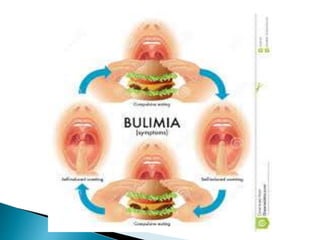 Nutrisi