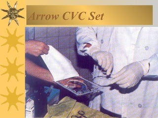 Arrow CVC Set
 