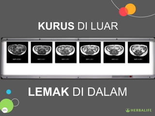 171
KURUS DI LUAR
LEMAK DI DALAM
 