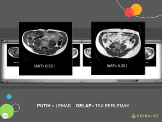 PUTIH = LEMAK GELAP= TAK BERLEMAK
172
 