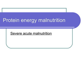 Protein energy malnutrition
Severe acute malnutrition
 