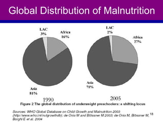Global Distribution of Malnutrition
18
 