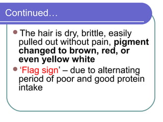 Continued…
The hair is dry, brittle, easily
pulled out without pain, pigment
changed to brown, red, or
even yellow white
‘Flag sign’ – due to alternating
period of poor and good protein
intake
 