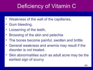 Deficiency of Vitamin C
• Weakness of the wall of the capillaries,
• Gum bleeding,
• Loosening of the teeth,
• Browsing of the skin and petechia
• The bones become painful, swollen and brittle
• General weakness and anemia may result if the
disorder is not treated.
• Skin abnormalities such as adult acne may be the
earliest sign of scurvy
355
 