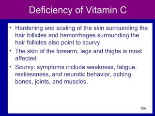 Deficiency of Vitamin C
• Hardening and scaling of the skin surrounding the
hair follicles and hemorrhages surrounding the
hair follicles also point to scurvy
• The skin of the forearm, legs and thighs is most
affected
• Scurvy: symptoms include weakness, fatigue,
restlessness, and neurotic behavior, aching
bones, joints, and muscles.
356
 