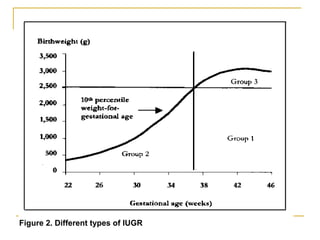 Figure 2. Different types of IUGR
 