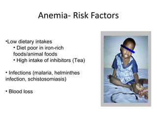•Low dietary intakes
• Diet poor in iron-rich
foods/animal foods
• High intake of inhibitors (Tea)
• Infections (malaria, helminthes
infection, schistosomiasis)
• Blood loss
Anemia- Risk Factors
 