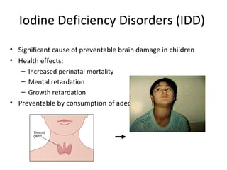 Iodine Deficiency Disorders (IDD)
• Significant cause of preventable brain damage in children
• Health effects:
– Increased perinatal mortality
– Mental retardation
– Growth retardation
• Preventable by consumption of adequately iodized salt
 
