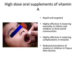 High dose oral supplements of vitamin
A
• Rapid and targeted
• Highly effective in lowering
mortality in infants and
children in third world
communities
• Highly effective in reducing
complications in measles
• Reduced prevalence of
malaria in children in Papua
New Guinea
 