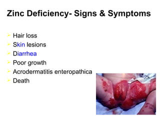 Zinc Deficiency- Signs & Symptoms
 Hair loss
 Skin lesions
 Diarrhea
 Poor growth
 Acrodermatitis enteropathica
 Death
 