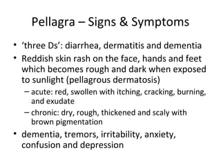 Pellagra – Signs & Symptoms
• ‘three Ds’: diarrhea, dermatitis and dementia
• Reddish skin rash on the face, hands and feet
which becomes rough and dark when exposed
to sunlight (pellagrous dermatosis)
– acute: red, swollen with itching, cracking, burning,
and exudate
– chronic: dry, rough, thickened and scaly with
brown pigmentation
• dementia, tremors, irritability, anxiety,
confusion and depression
 