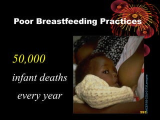 Poor Breastfeeding Practices
50,000
infant deaths
every year
UNICEF/93-COU-0173/Lemoyne
593
 