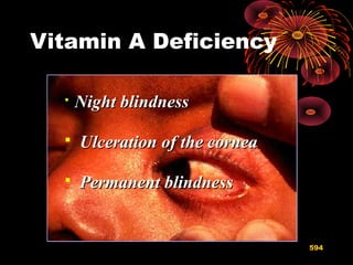 Vitamin A Deficiency

Night blindnessNight blindness
 Ulceration of the corneaUlceration of the cornea
 Permanent blindnessPermanent blindness
594
 