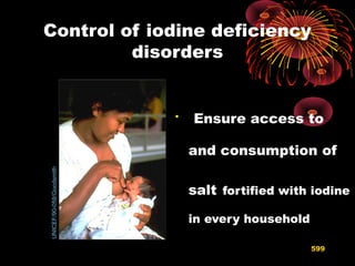 Control of iodine deficiency
disorders

Ensure access to
and consumption of
salt fortified with iodine
in every household
UNICEF/90-058/Goodsmith
599
 
