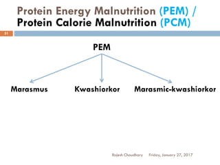 Protein Energy Malnutrition (PEM) /
Protein Calorie Malnutrition (PCM)
Friday, January 27, 2017Rajesh Chaudhary
51
PEM
Marasmus Kwashiorkor Marasmic-kwashiorkor
 