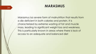24
MARASMUS
Marasmus isa severe form of malnutrition that results from
a die deficient in both calories and protein. It is
characterized by extreme wasting of fat and muscle
mass, leading to significant weight loss and weakness.
This is particularly known in areas where there is lack of
access to an adequate and balanced diet
 