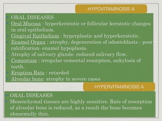 ORAL DISEASES
Oral Mucosa : hyperkeratotic or follicular keratotic changes
in oral epithelium.
Gingival Epithelium : hyperplastic and hyperkeratotic.
Enamel Organ : atrophy, degeneration of odontoblasts - poor
calcification- enamel hypoplasia.
Atrophy of salivary glands- reduced salivary flow.
Cementum : irregular cemental resorption, ankylosis of
teeth.
Eruption Rate : retarded
Alveolar bone: atrophy in severe cases
HYPOVITAMINOSIS A
HYPERVITAMINOSIS A
ORAL DISEASES
Mesenchymal tissues are highly sensitive. Rate of resorption
of alveolar bone is reduced, as a result the bone becomes
abnormally thin.
 