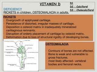 VITAMIN D D1
D2 : Calciferol
D3 : CholecalciferolDEFICIENCY
RICKETS in children. OSTEOMALACIA in adults.
RICKETS
• Overgrowth of epiphyseal cartilage.

• Persistence of distorted, irregular masses of cartilage.

• Deposition o osteoid matrix in inadequately mineralized
cartilaginous remnants.

• Disruption of orderly placement of cartilage by osteoid matrix.

• Deformation due to loss of structural rigidity of developing bones.
OSTEOMALACIA
• Contours of bones are not aﬀected.

• Bone is weak and vulnerable to
gross fractures.

• most likely aﬀected- vertebral
bodies and femoral necks.
 
