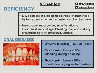 DEFICIENCY
Development of a bleeding diathesis characterized
by hematomas, hematuria, malena and ecchymoses.

In neonates, most serious manifestation is
intracranial hemorrhage. Bleeding may occur at any
site, including skin, umbilicus, viscera.
VITAMIN K K1 (Phytodione)
K2 (Menadione)
ORAL DISEASES
Gingival bleeding (most common)

Prothrombin levels <35% -
Bleeding during brushing.

Prothrombin levels <20% -
spontaneous gingival hemorrhage.
 