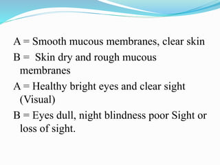 A = Smooth mucous membranes, clear skin
B = Skin dry and rough mucous
membranes
A = Healthy bright eyes and clear sight
(Visual)
B = Eyes dull, night blindness poor Sight or
loss of sight.
 