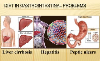 DIET IN GASTROINTESTINAL PROBLEMS
Liver cirrhosis Hepatitis Peptic ulcers
 