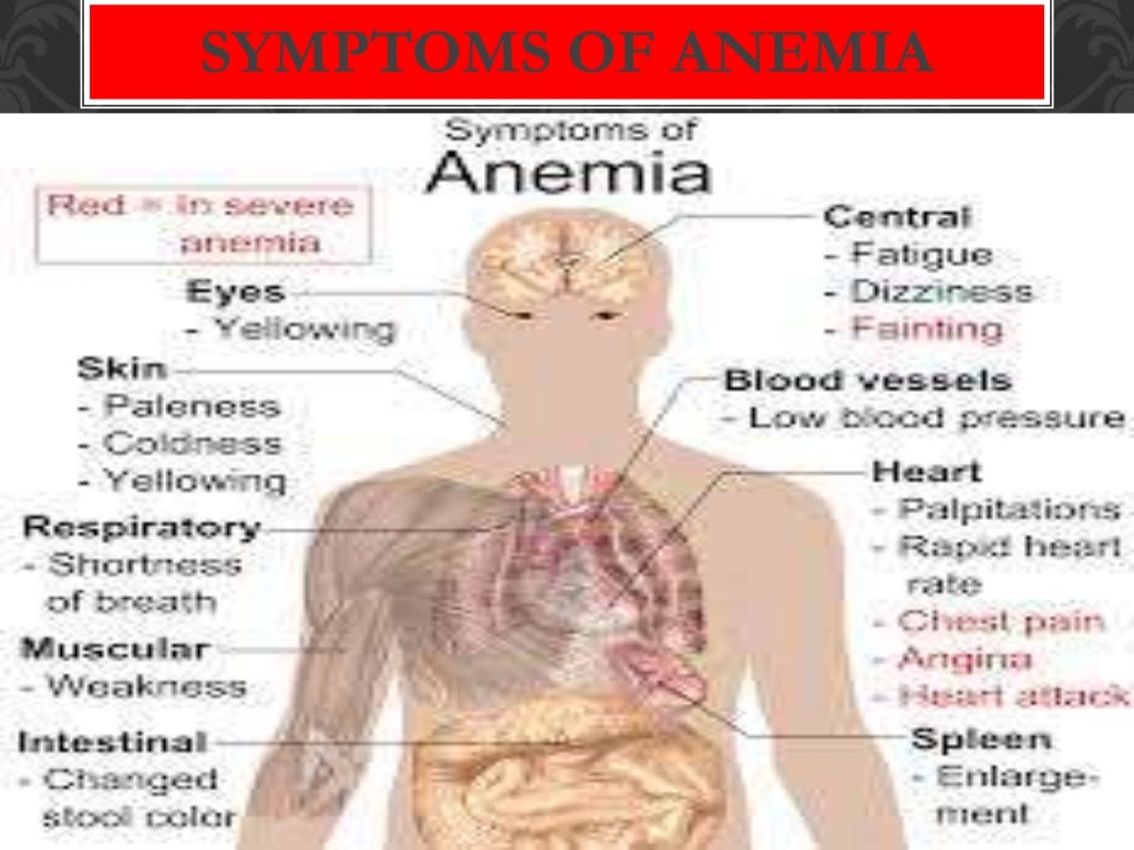Nutritional anemia Dr JP Singh, Dept, of community medicine, SRMS IM…