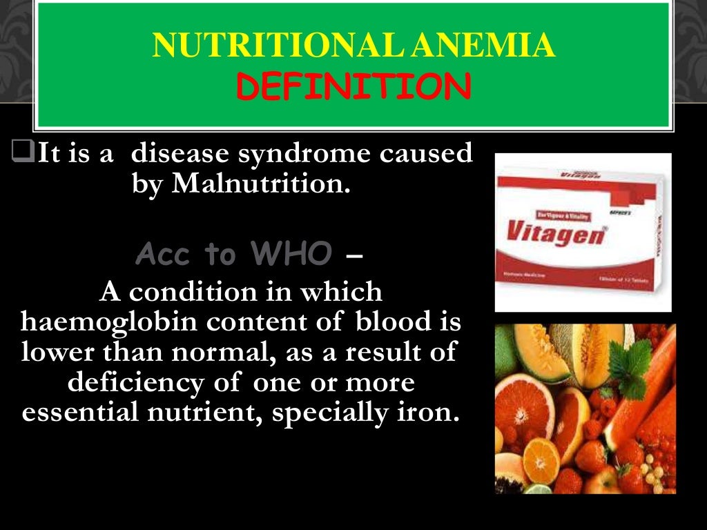 Nutritional anemia Dr JP Singh, Dept, of community medicine, SRMS IM…