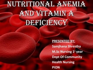 NUTRITIONAL ANEMIANUTRITIONAL ANEMIA
AND VITAMIN AAND VITAMIN A
DEFICIENCYDEFICIENCY
PRESENTED BY:
Samjhana Shrestha
M.Sc Nursing 1st
year
Dept Of Community
Health Nursing
PION
 