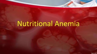 Nutritional Anemia
 