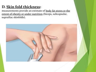 D. Skin fold thickness:
measurements provide an estimate of body fat stores or the
extent of obesity or under nutrition.(biceps, subcapsular,
suprailiac skinfolds).
 