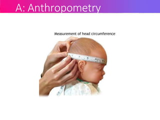 A: Anthropometry
 
