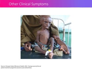 Other Clinical Symptoms
(Source: Ethiopian Federal Ministry of Health, 2010, Training course of the out
patient treatment programme of severe acute malnutrition)
 